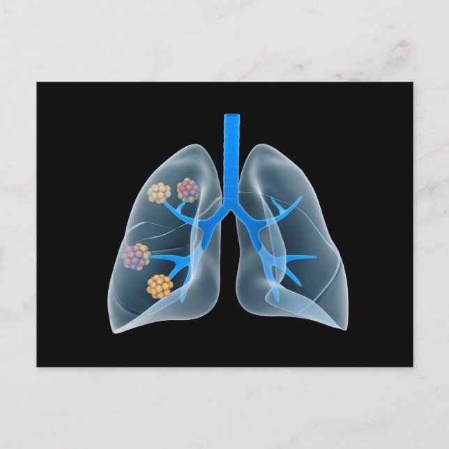 Konzeptuelles Bild des menschlichen Herzens 4 Postkarte (Vorderseite)