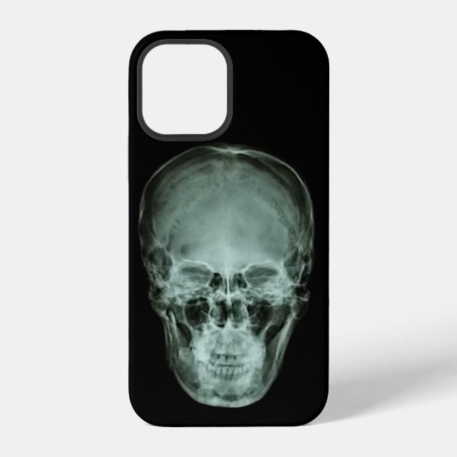 Kopf Schädel Röntgen iPhone Hülle (Rückseite)
