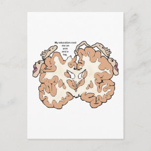 Kosten Sie einen Arm und ein Bein homunculus Postkarte