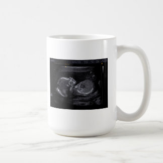 Kundengebundene Ultraschall-Tasse Tasse