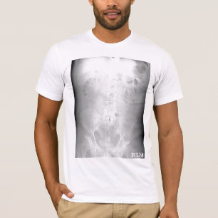 L-5/S1 CT Scan-abzeichnen-durch KLM T-Shirt