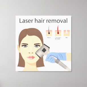 Laser-Haarentfernungsstruktur Leinwanddruck