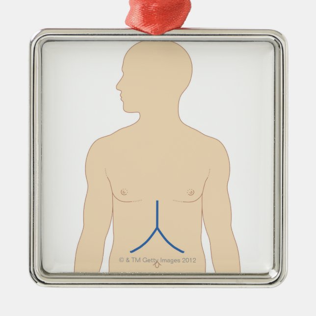 Leber-Transplantation Silbernes Ornament (Vorne)