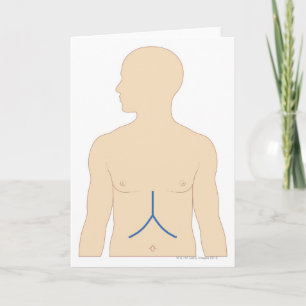 Lebertransplantation Karte