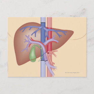 Lebertransplantation Postkarte