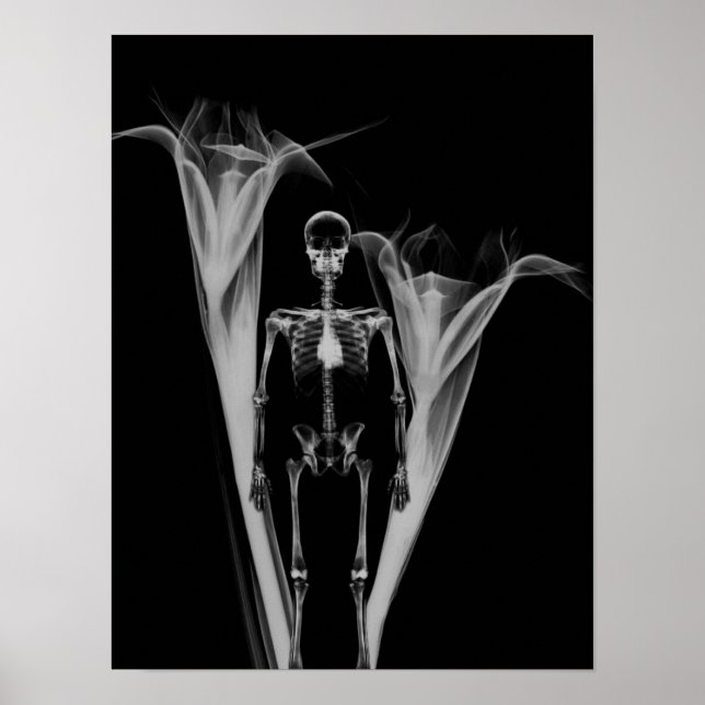 Little Human X-Ray Skeleton & Blume - B&W Poster (Vorne)