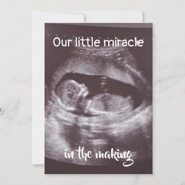 Little Miracle Ultrasound 2 Foto Baby Family Ankündigung (Vorderseite)