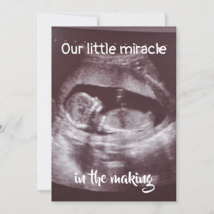 Little Miracle Ultrasound 2 Foto Baby Family Ankündigung