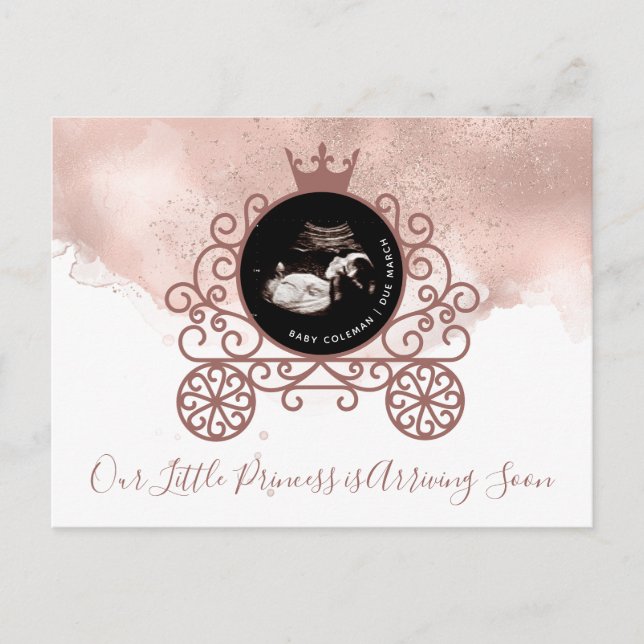 Little Princess Sonogram Pregnancy Ankündigung (Vorderseite)