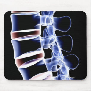 Lumbar Vertebrae 2 Mousepad