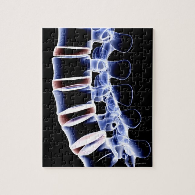 Lumbar Vertebrae 2 Puzzle (Vertikal)