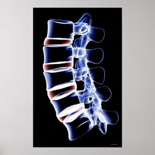 Lumbar Vertebrae Poster