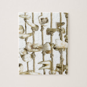 Lustige zahnmedizinische Fotografie extrahierter Puzzle