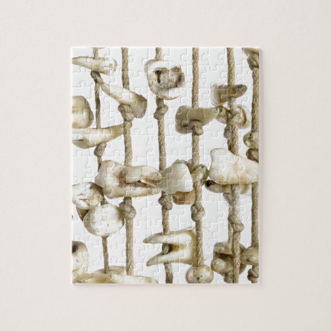 Lustige zahnmedizinische Fotografie extrahierter Puzzle (Vertikal)