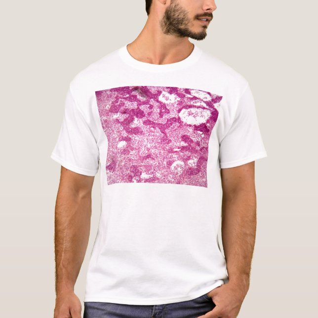Lymphknotenzellen unter dem Mikroskop T-Shirt (Vorderseite)