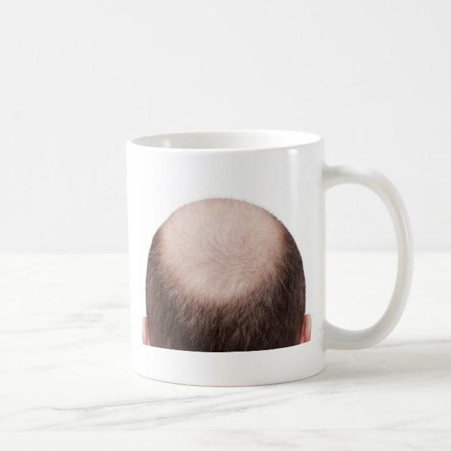 Männlicher Muster Baldness Tasse (Rechts)