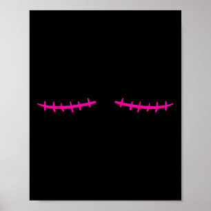 Mastektomie Brustkrebserkrankung Poster