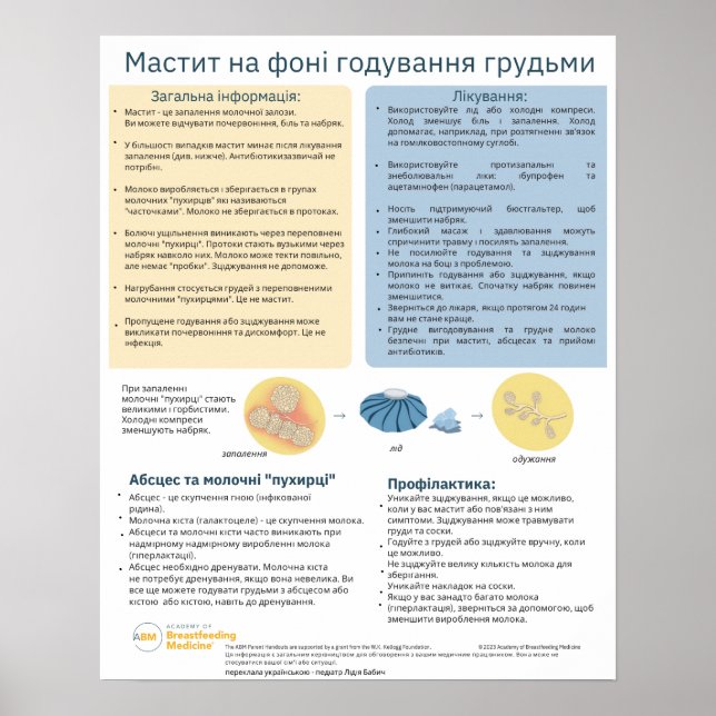 Mastitis im Stillen Poster (Ukrainisch) (Vorne)