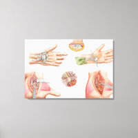 Medizinische Illustration mit Carpal Tunnel