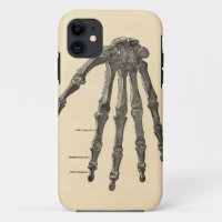 Medizinischer Anatomie-Handknochen iPhone Fall