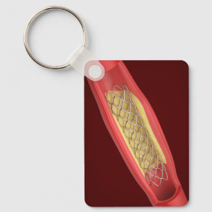Medizinischer Stent in einem Blutgefäß Schlüsselanhänger