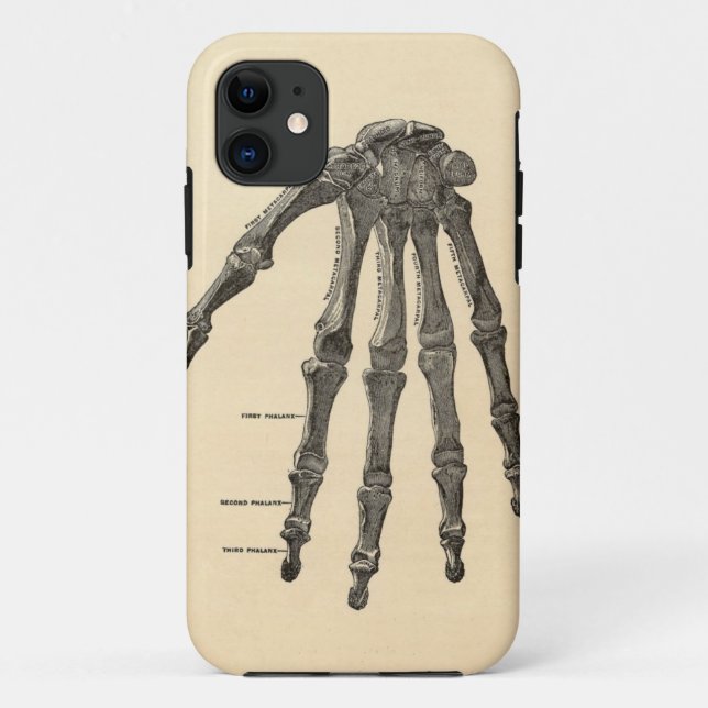 Medizinisches Anatomie-Handknochen-iPhone-Case Case-Mate iPhone Hülle (Rückseite)