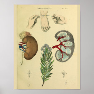 Medizinisches Handgelenk Chirurgie Nieren Anatomie Poster