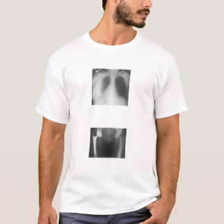 Mein angesagtes gerade gebrochenes von der T-Shirt