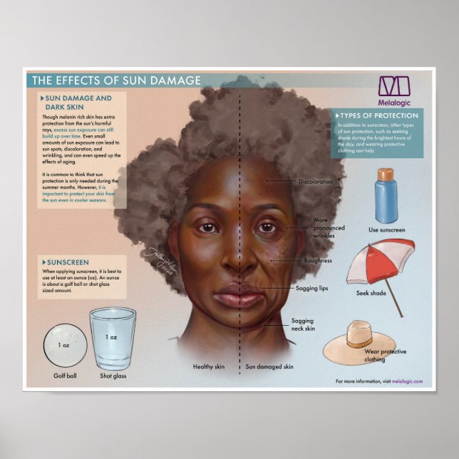 Melalogic Die Auswirkungen von Sonnenschäden Mediz Poster (Vorne)