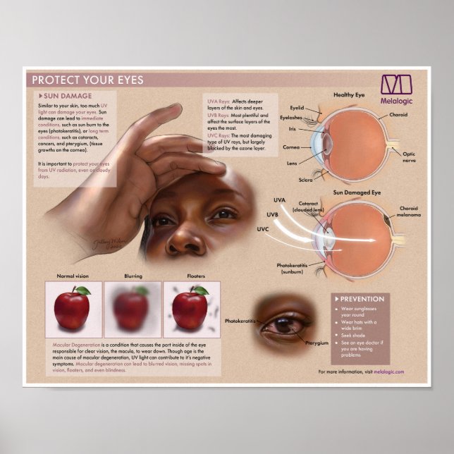 Melalogic Eye Protection Medical Poster (Vorne)
