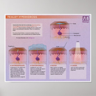 Melalogic Hyperhidrosis Medical Poster