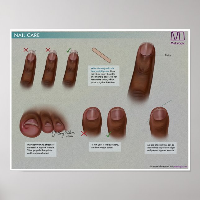 Melalogic Nail Care Medical Poster (Vorne)