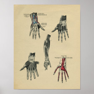Menschliche Handarm-Anatomie 1902 Vintager Druck Poster