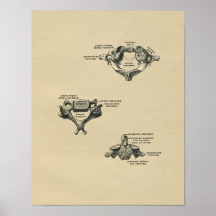 Menschliche Wirbel-Anatomie 1902 Vintager Druck Poster