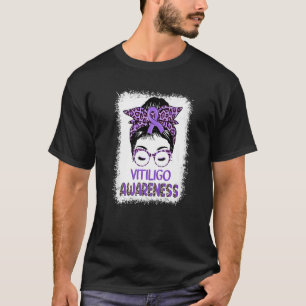 Messy Bun Girl Lila Ribbon Vitiligo Bewusstsein T-Shirt