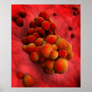 Mikroskopische Ansicht von Tumor 2 Poster