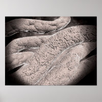 Mikroskopische Darstellung der Corncob-Formation
