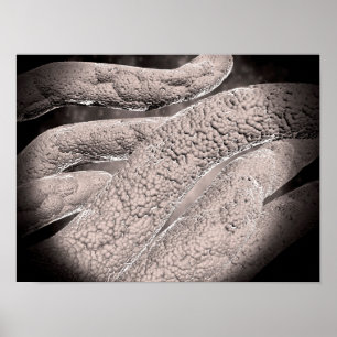 Mikroskopische Darstellung der Corncob-Formation Poster