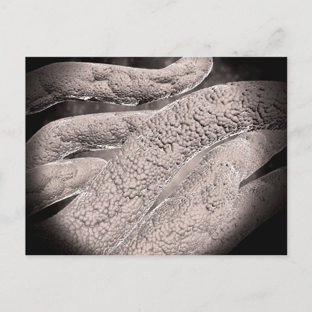 Mikroskopische Darstellung der Corncob-Formation Postkarte (Vorderseite)