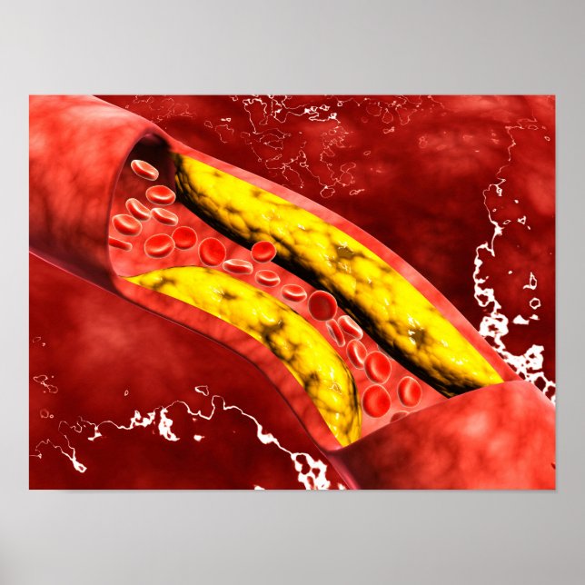 Mikroskopische Darstellung der Fettschicht innerha Poster (Vorne)