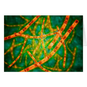 Mikroskopische Darstellung von Anthrax 2