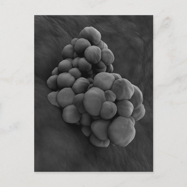 Mikroskopische Darstellung von Tumor 1 Postkarte (Vorderseite)