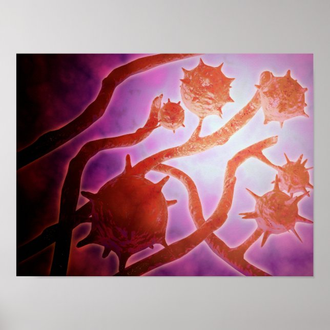 Mikroskopische Histoplasmose Poster (Vorne)