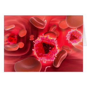 Mikroskopische Sicht auf das HIV-Virus in der Lung