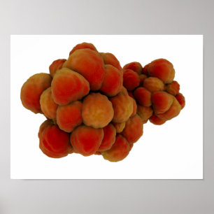 Mikroskopische Tumoransicht 4 Poster