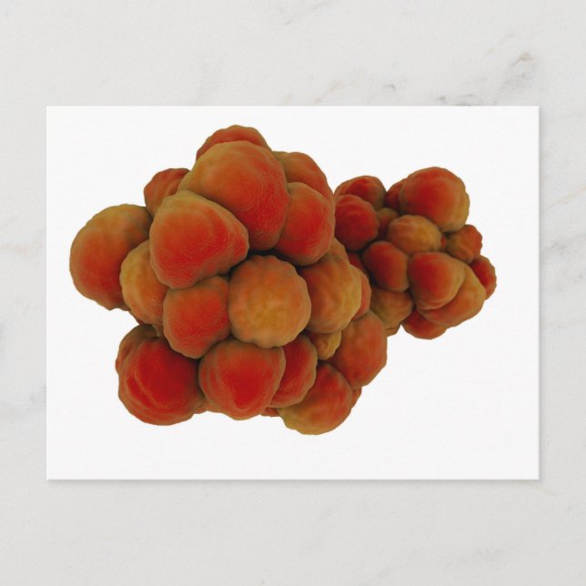 Mikroskopische Tumoransicht 4 Postkarte (Vorderseite)