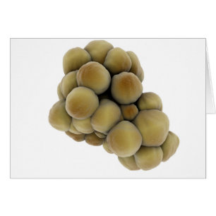 Mikroskopische Tumoransicht 5