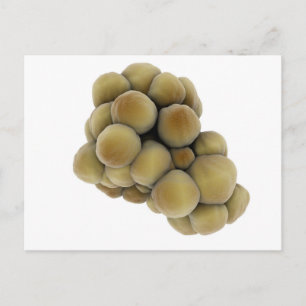 Mikroskopische Tumoransicht 5 Postkarte