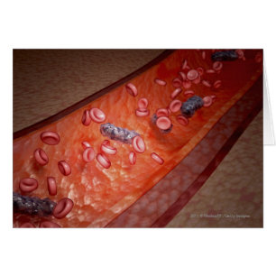 Mikroskopische Wiedergabe einer Blutinfektion