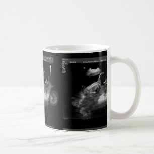 Motorradsonogram-Tasse Tasse